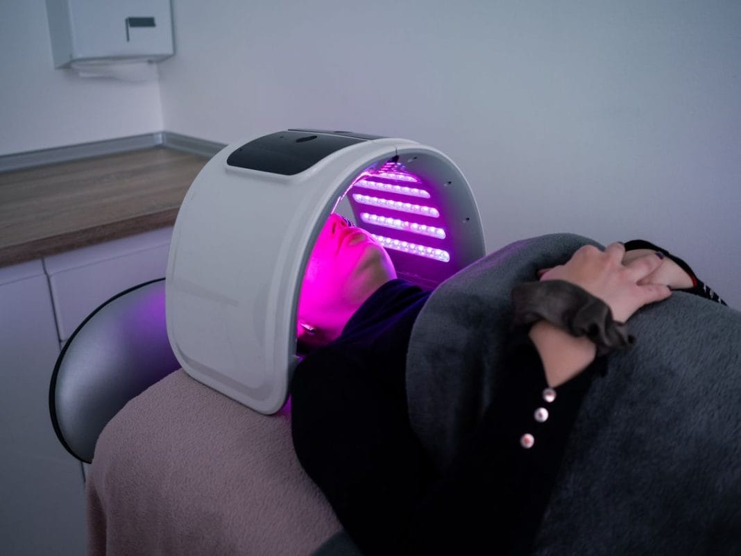 Traitement Routine Beauté : Intégrer la Photothermie Micro-Ciblée Épidermique (PMCE) Contre l’Acné